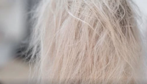 white blonde over-processed hair.