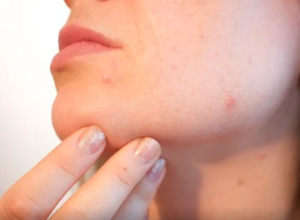Female checking her chin with her fingers.
