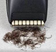 Management Of Unwanted Facial Hair