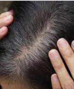 Hands showing the gray roots on medium brown hair.