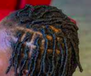Image of square partings for dreads/locs on a head of super curly hair.