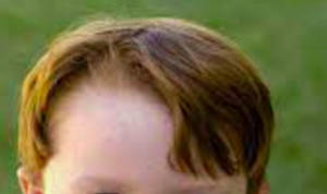 Red hair with a deep part at the hairline