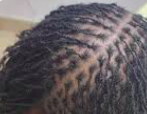 Why Are Sections In Some People’s Dreadlocks More Visible Than Others ...
