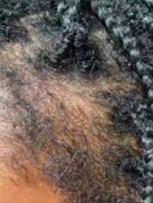 What Happens If You Leave Braids In Too Long | The Best Ottawa Hair Salon?