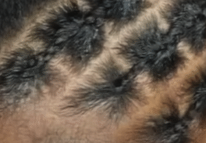 Black "illusion braids" on 4C hair.