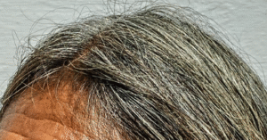 Straight, dark-gray hair.
