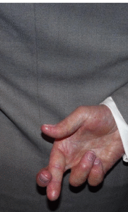 A hand with fingers crossed held behind the back of a grey suit
