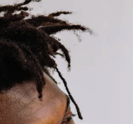 Dreadlocks Thinning Hair