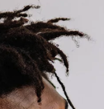 Dreadlocks Thinning Hair